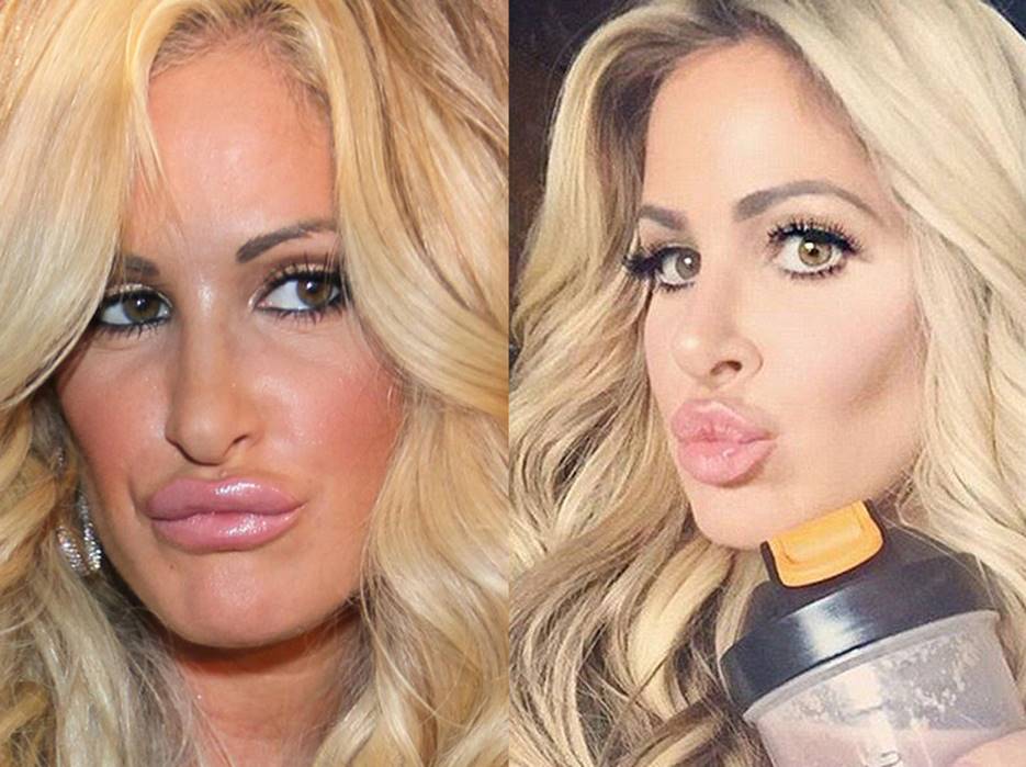 Kim Zolciak Before and After